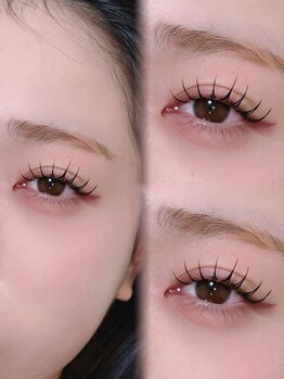 アテプラス(ate+)/アンドヘルシー