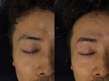 ラトリエ(L'Atelier)/HBL ビフォー/アフター