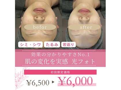 米子美人の写真