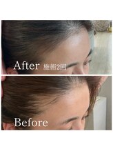 キュライム 熊本(CURAIM)/育毛促進【40代女性】