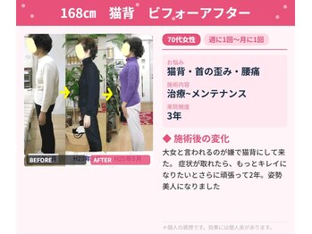 エスコート芦屋サロン/70代 女性 猫背 首痛