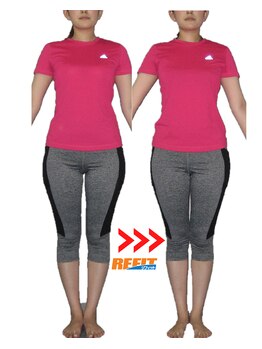 リフィット/膝下o脚の改善後