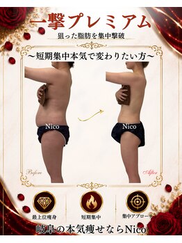 ニコ 岐南本店(Nico)の写真/【直接予約限定】短期集中で変わりたい方へ|最上位痩身「一撃プレミアム」体験 55,000~