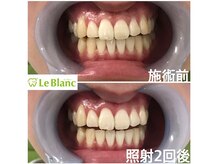 ルブラン 奈良店(Le Blanc)/第一印象アップ！！