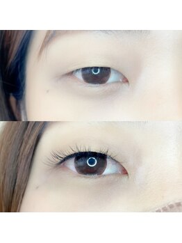 ルピナス 国分寺店(Lupinus)/LEDフラットラッシュ120本