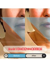 ブルハ(Bruja)/小顔矯正『コルギ』B2