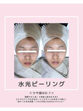 ソワナ(soina)/【神楽坂駅/フェイシャル/毛穴】