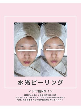 ソワナ(soina)/【神楽坂駅/フェイシャル/毛穴】