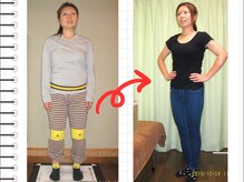 チャラク(charaku)/【35才悩み】肩こり・歪み・体型