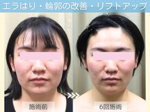 小顔矯正専門店 シンメトリー 梅田