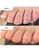 ケアプラス(care plus)/フットネイルケア