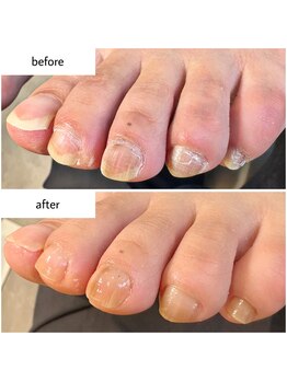 ケアプラス(care plus)/フットネイルケア