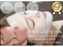 ローズフィールド(Rosefield)/RFピール/ニキビ/シミ/毛穴