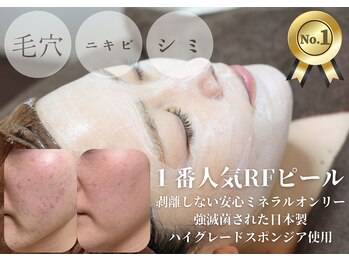 ローズフィールド(Rosefield)/RFピール/ニキビ/シミ/毛穴