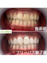 ルブラン 奈良店(Le Blanc)/めちゃくちゃ清潔感でます！