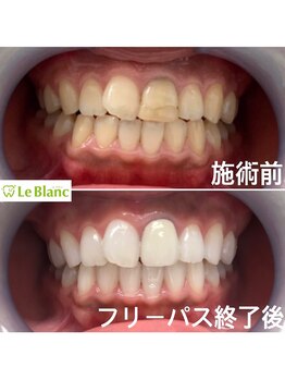 ルブラン 奈良店(Le Blanc)/めちゃくちゃ清潔感でます！