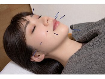 東垣鍼院の写真/【コスメコンシェルジュ資格保有/女性鍼灸師在籍♪】女性特有のお悩みや細かな肌トラブルもご相談下さい◎