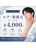 【メンズ人気NO.1】｜ ひげ・顔全体　￥4,000　青ヒゲ改善