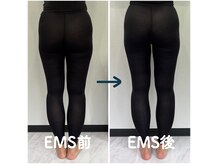 セア(SeA)の雰囲気（1回のEMSでヒップアップ！キュッと引き締まったヒップへ！）
