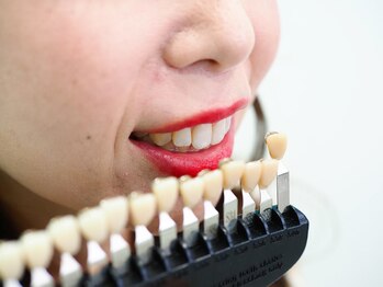 ホワイトニングカフェ 守山店/歯のお色味チェック