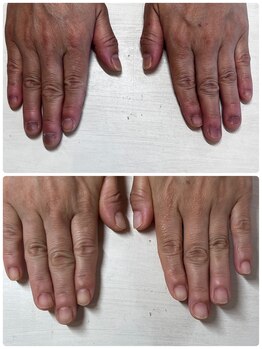 ヴェールリム(verl lim)/