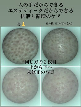 コルッソ(CoLusson.)/オールハンド循環排泄促進ケア