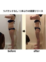 クリア(Clear)/筋膜リリースメンテナンス