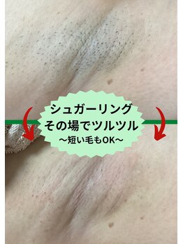 ディスイズミー シュガーリング(This is me Sugaring)/【シュガー】自己処理卒業