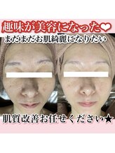 アルムダアクア 天王寺店(Aleumda AQUA)/ハーブピーリング/大阪/天王寺