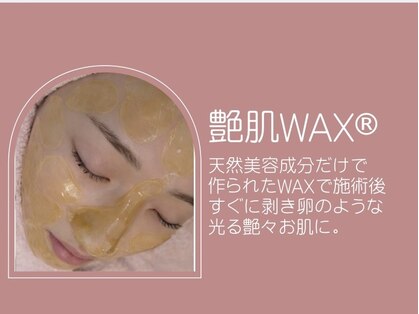 ルサンク(le cinq)の写真