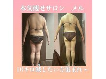 メル