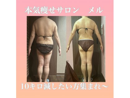 メルの写真