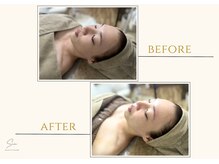 セン(Sen)/ビフォーアフター