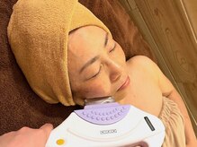 ヘルシースリム 東浦和/全顔脱毛　産毛までスッキリ