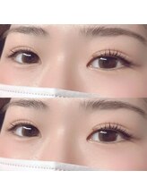 ミシェル(MICHELL)/まつ毛パーマ