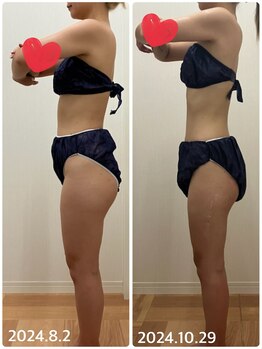 リル(Lil)/約3ヶ月でこんなに変化！