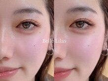 ベル リラ(Belle Lilas)