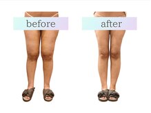 カド 白金台(Kado)/高評価◆DTケア/インディバ