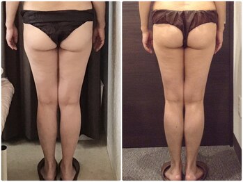 美容整体ウェリナ 名駅院/小顔矯正/骨盤矯正/美脚サロン