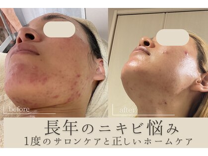 ミュー 吉祥寺店(mieux)の写真