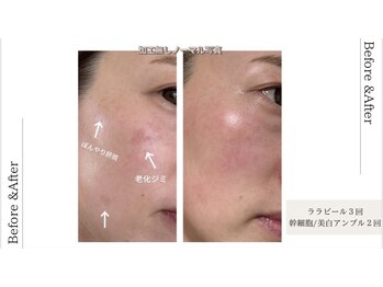 ルルアス(LuLu AS)/