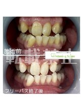 ホワイトニングサロン 札幌店/【ホワイトニング】#札幌#大通り