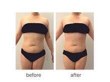 ナチュラル ユース(Natural youth)の雰囲気（上半身コース5回目の変化です！特に下腹部の変化が素晴らしい！）