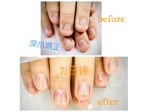 ヒロネイル(Hiro Nail)の雰囲気（フットジェル付け放題♪）