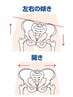 【美容整体】★骨盤矯正・猫背・O脚・そり腰・足のむくみ・産後の骨盤改善◎