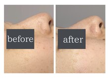 ロカヒ(Lokahi)/くすみいろむらに光フェイシャル