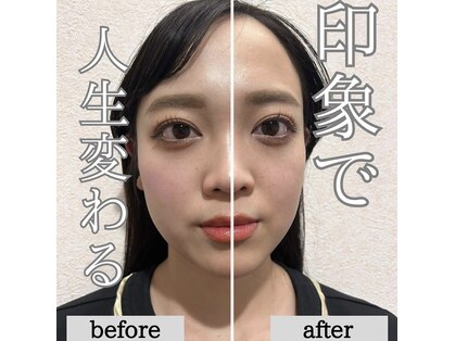 骨盤ストレッチ整体 bの写真