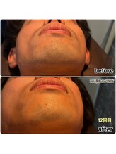 シンバ 倉敷店(SIMBA)/