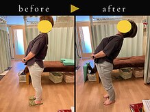 杉本接骨鍼灸院/大事にならずに済みました！