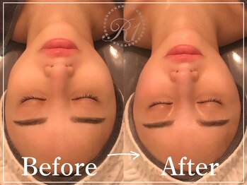 R-1ビューティーサロン 表参道/Before&After